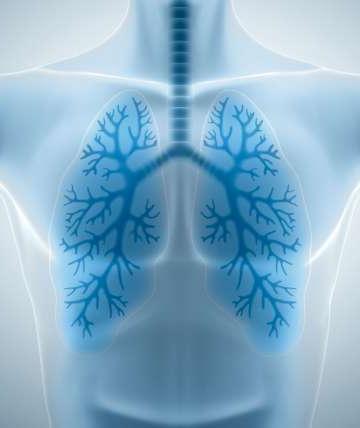 肺部扫描图